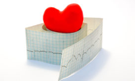 βραδυκαρδία