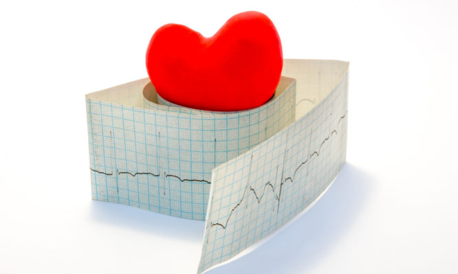 βραδυκαρδία