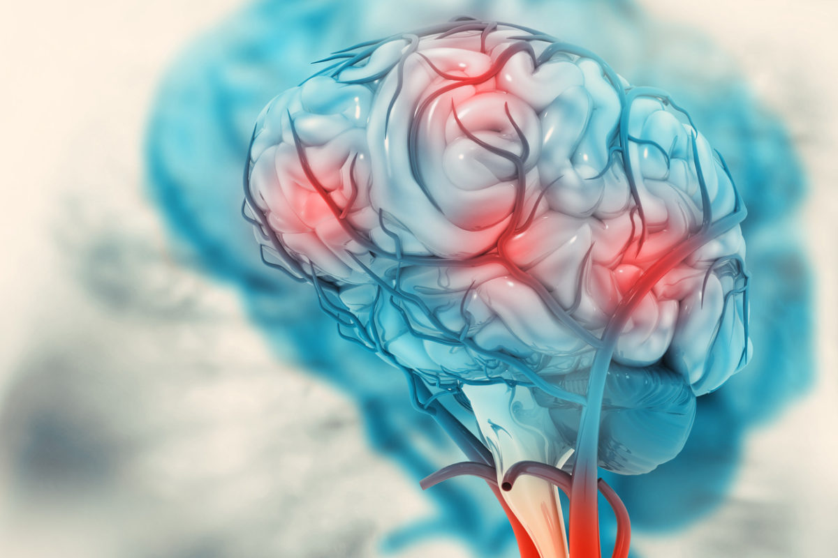 εγκεφαλικό