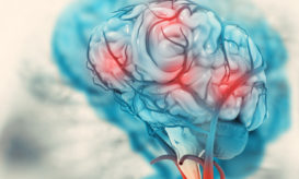 εγκεφαλικό