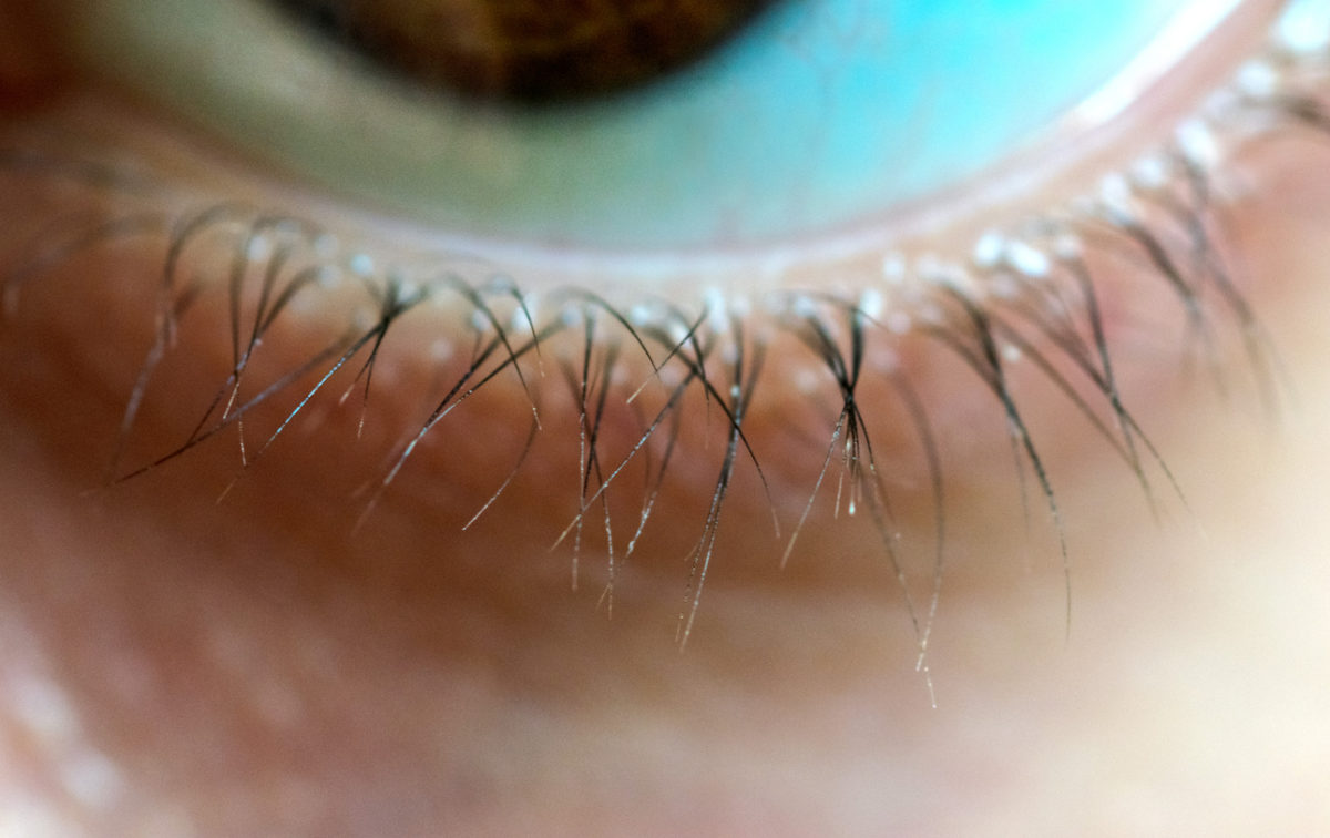 ξηρές τσίμπλες