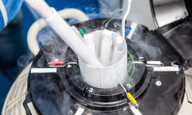 Υποβοηθούμενης Αναπαραγωγής