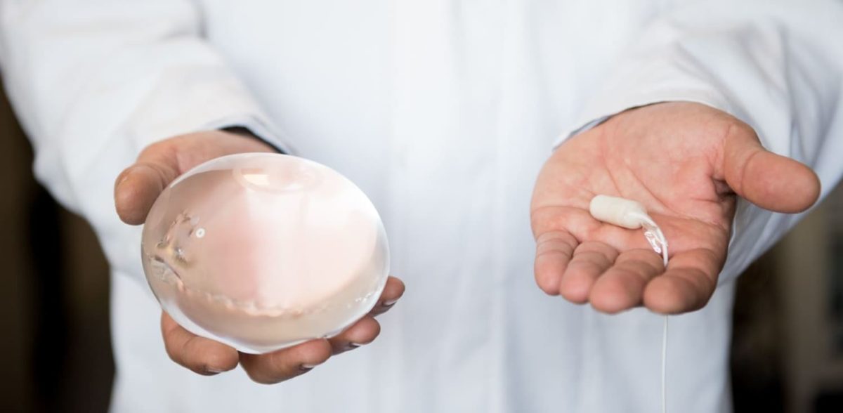 γαστρικό μπαλόνι