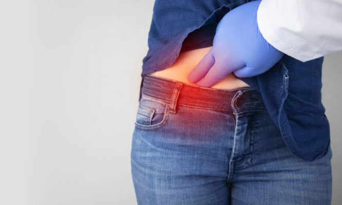 σκωληκοειδίτιδα