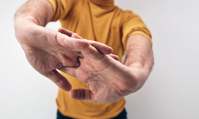 πρησμένα δάχτυλα