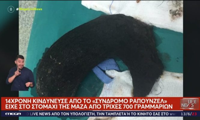 μαλλιά