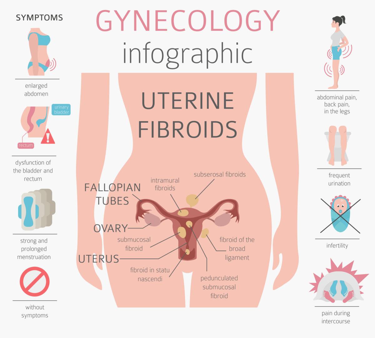 ινομυώματα μήτρας