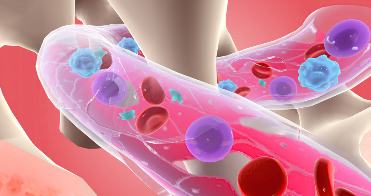 μυελομονοκυτταρική λευχαιμία