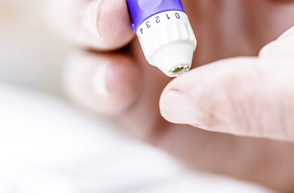 Αλτσχάιμερ