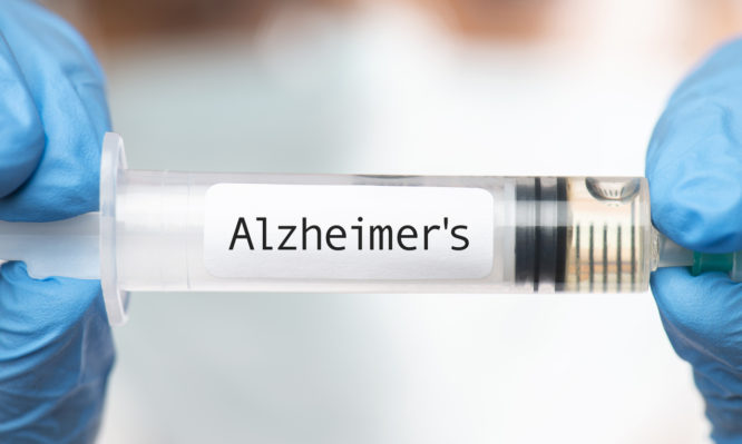 Αλτσχάιμερ