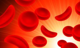 δρεπανοκυτταρική αναιμία