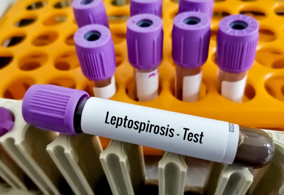 λεπτοσπείρωση