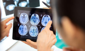 εγκεφαλικά