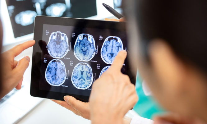 εγκεφαλικά