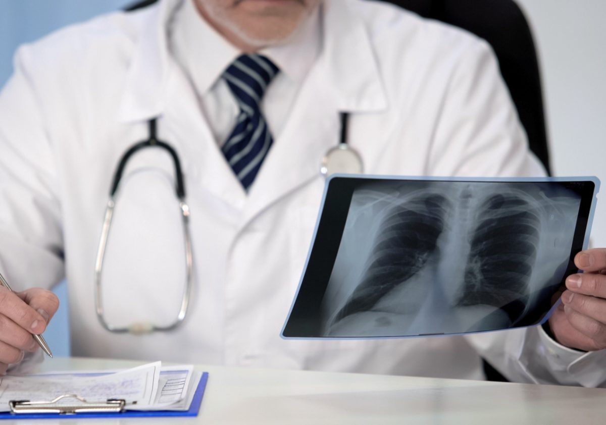 μεταμόσχευση