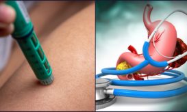 παχυσαρκία