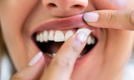 στικάκια νικοτίνης