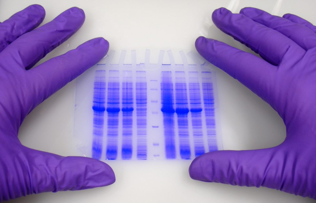 γαμμαπάθεια