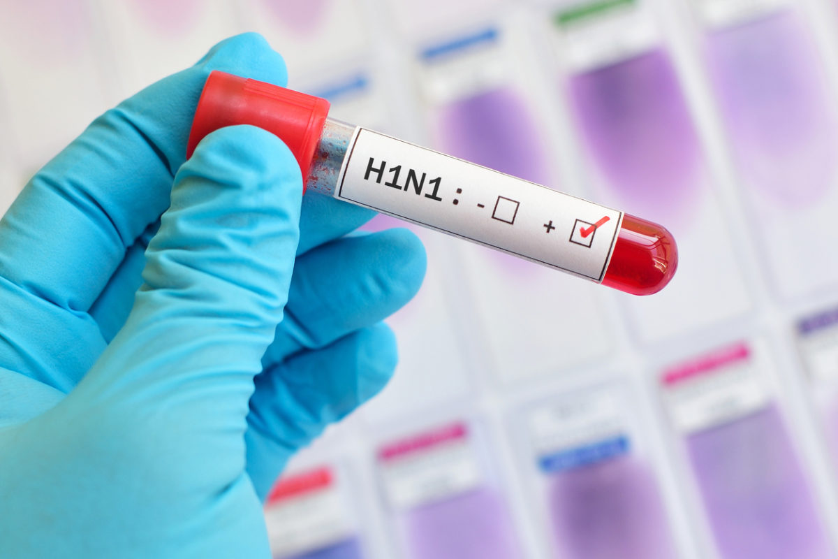 H1N1