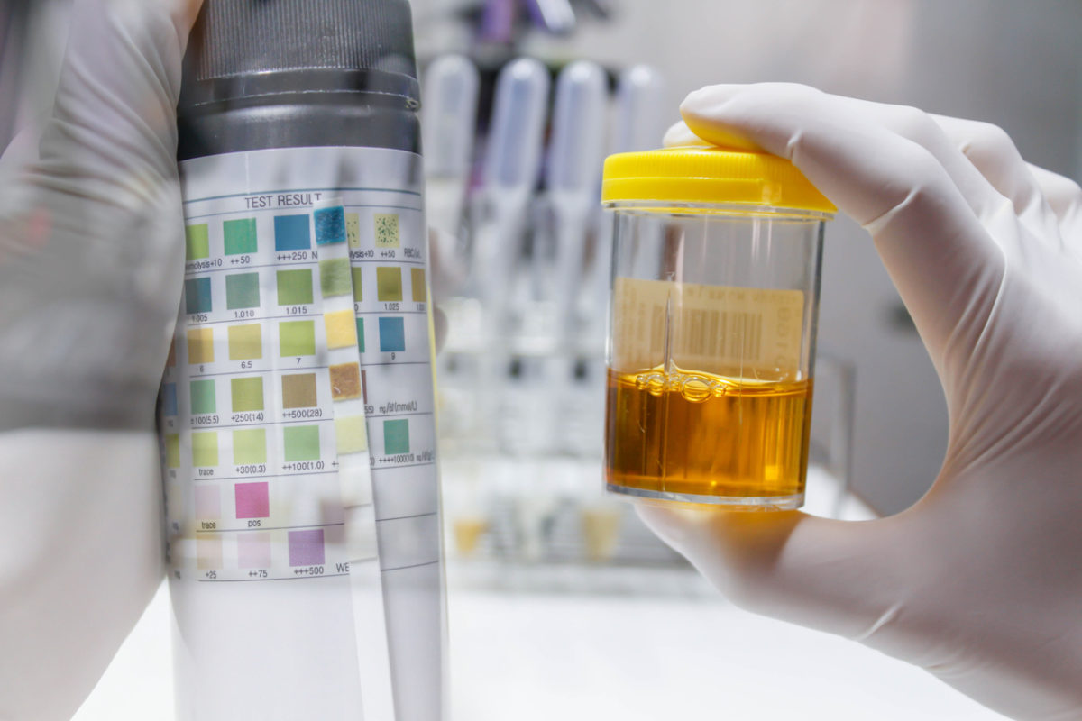 καρκίνος των ωοθηκών