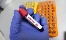 τεστ για γονόρροια