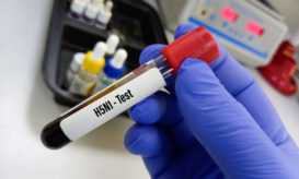 Δείγμα αίματος για εξέταση για H5N1, γρίπη των πτηνών