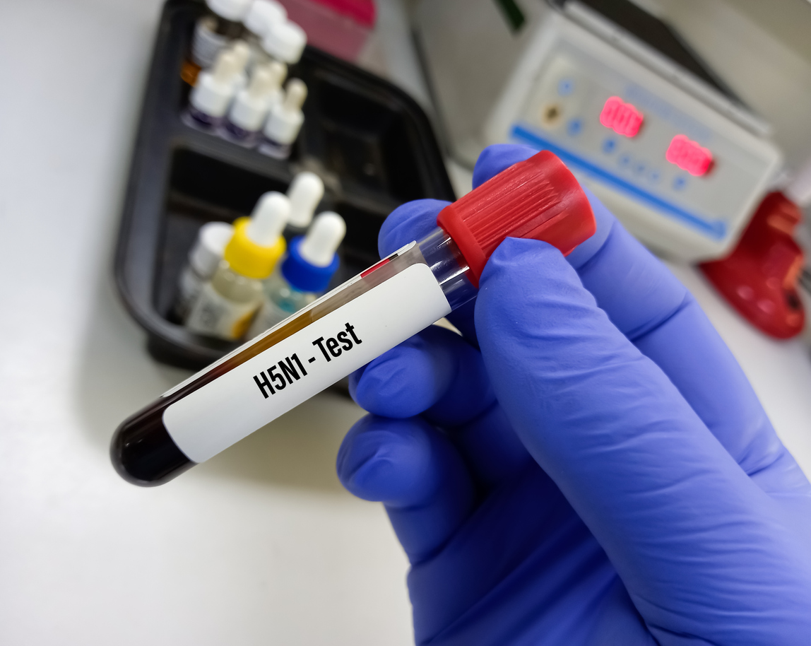 Δείγμα αίματος για εξέταση για H5N1, γρίπη των πτηνών