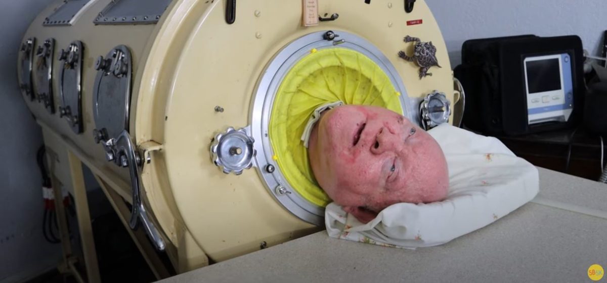 σιδερένιος πνεύμονας