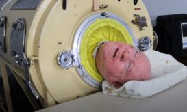 σιδερένιος πνεύμονας