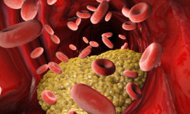 τριγλυκερίδια, χοληστερόλη