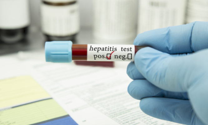 τεστ για ηπατίτιδα