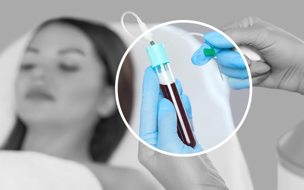 μεσοθεραπεία