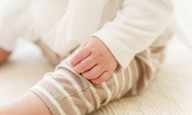 παχυσαρκία