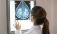 καρκίνος του μαστού, μαστογραφία