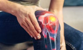 αρθροπλαστική