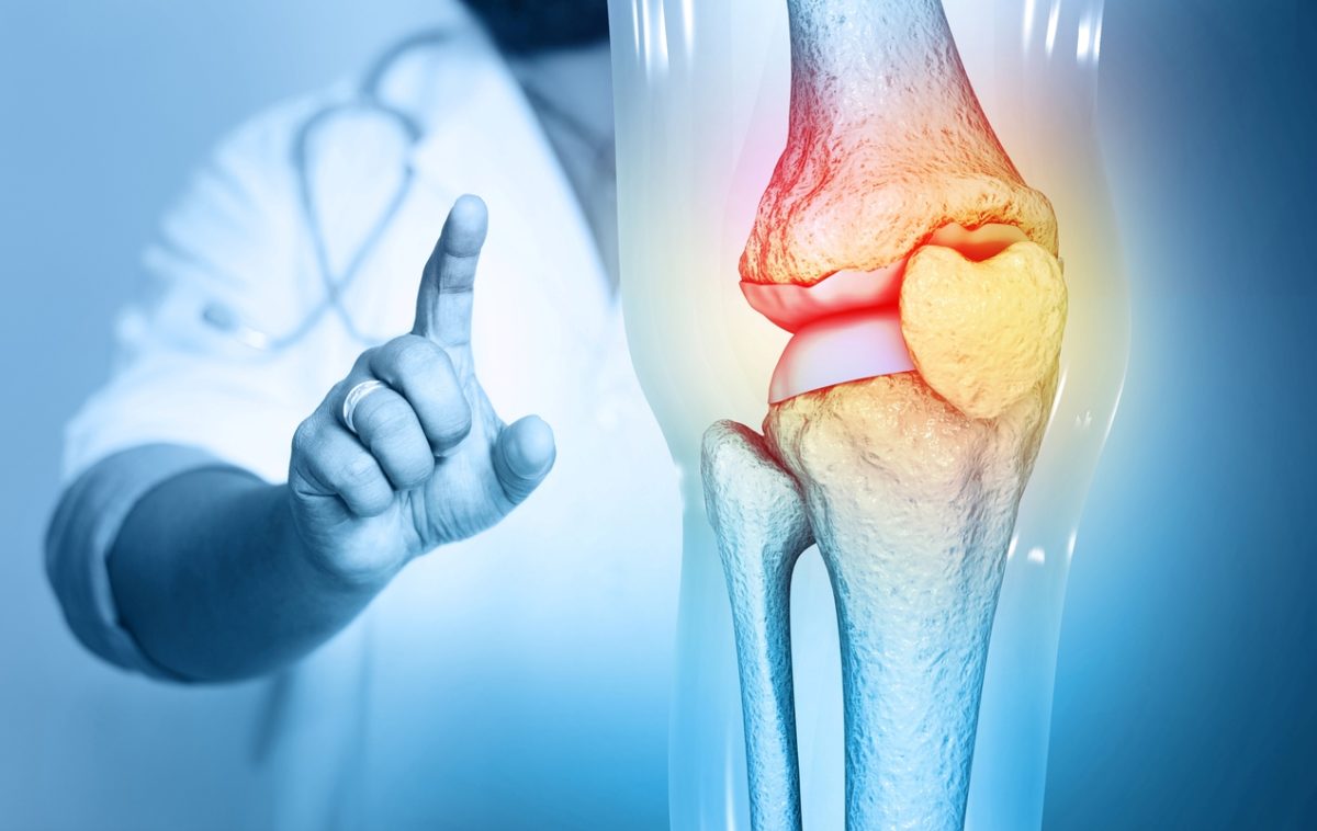 οστεοαρθρίτιδα