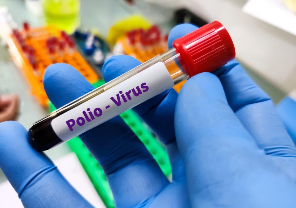 πολιομυελίτιδα