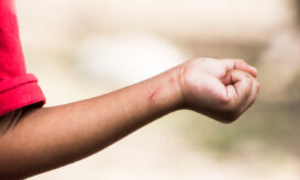 αυτοτραυματισμός