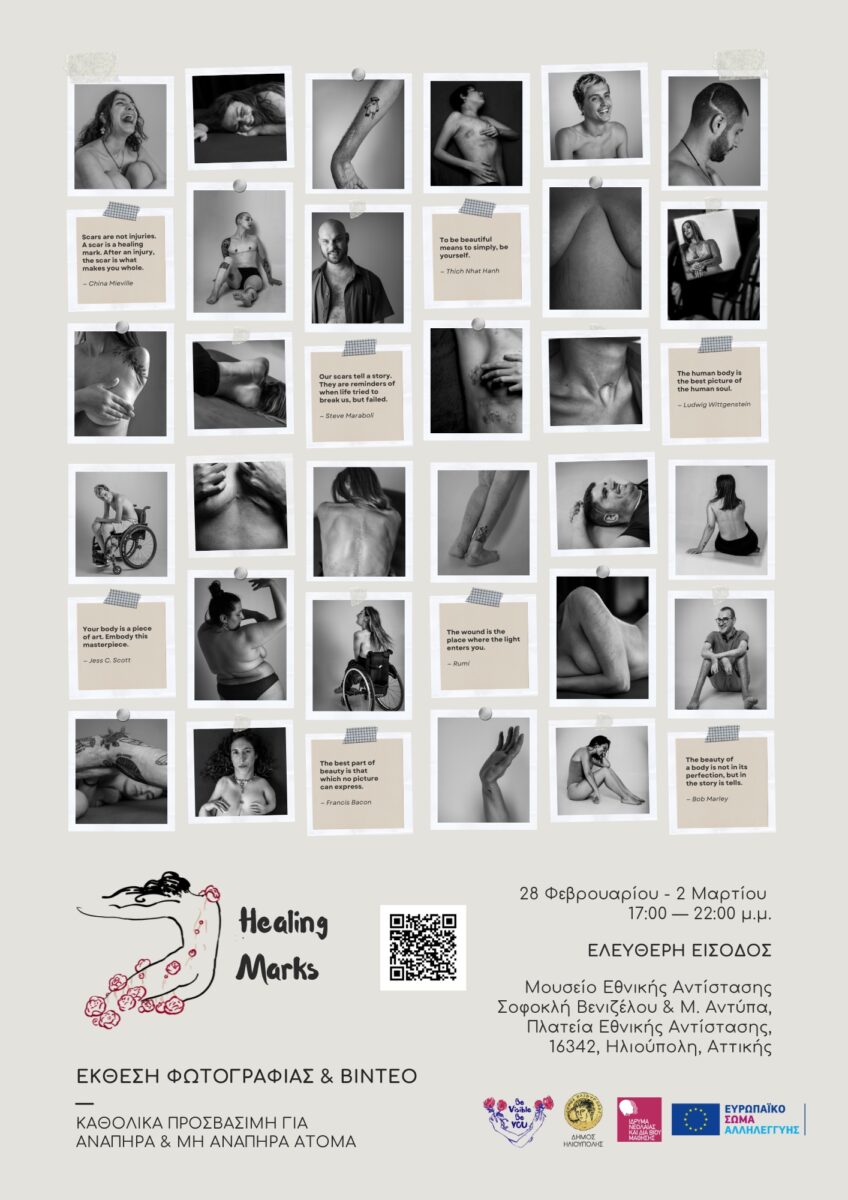 Healing Marks: Μια έκθεση για τη δύναμη της αυτοαποδοχής και την κατάρριψη στιγματιστικών προτύπων ομορφιάς