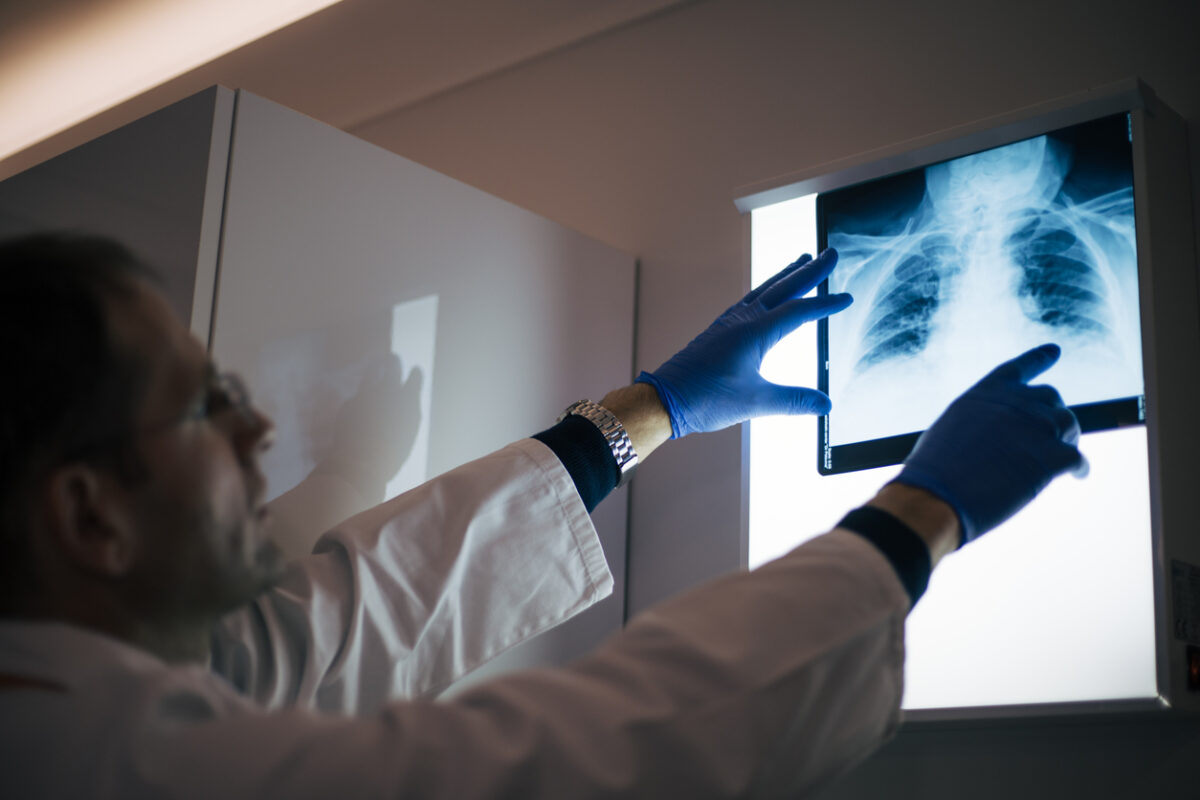 διπλή πνευμονία