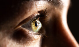 κερατόκωνος