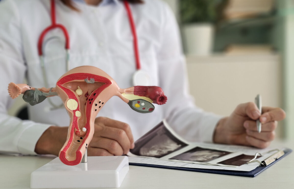 ινομυώματα και γονιμότητα