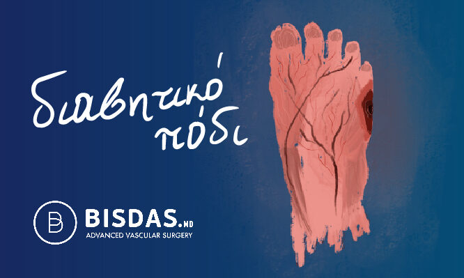 διαβητικό πόδι