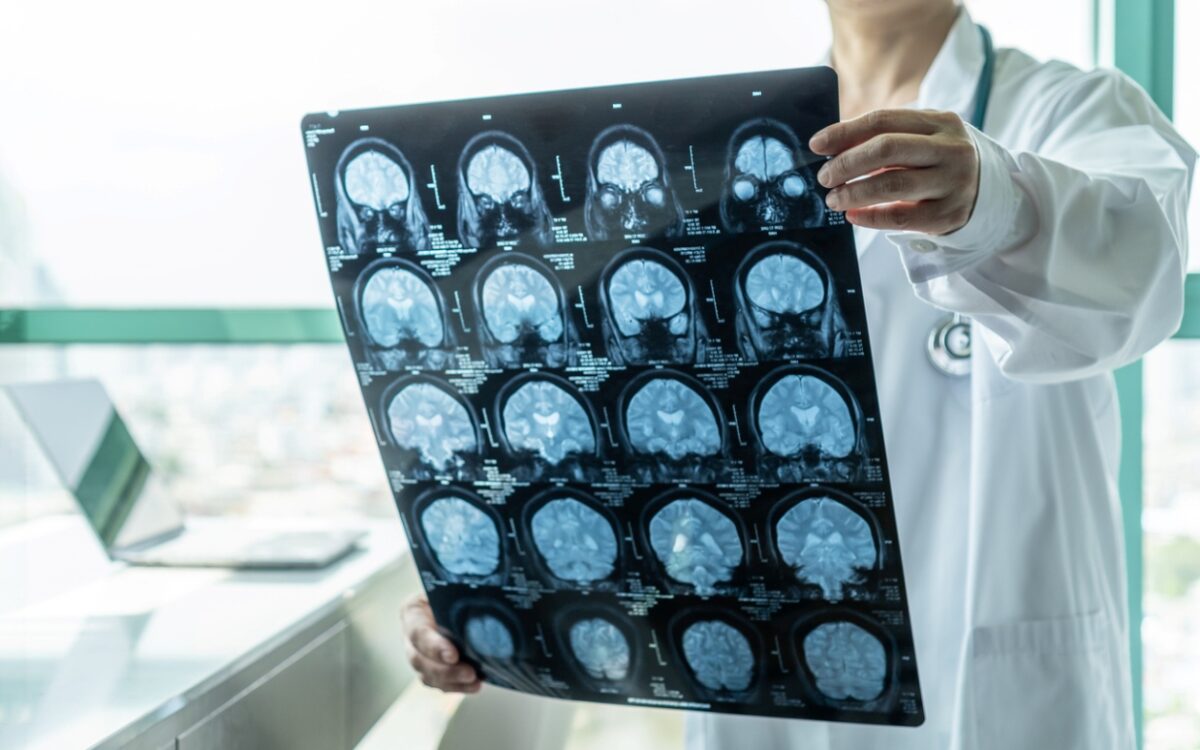 εγκεφαλίτιδα