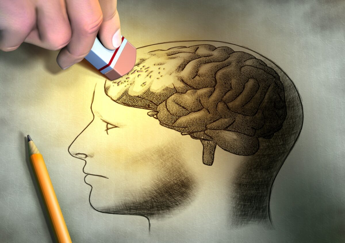 Αλτσχάιμερ