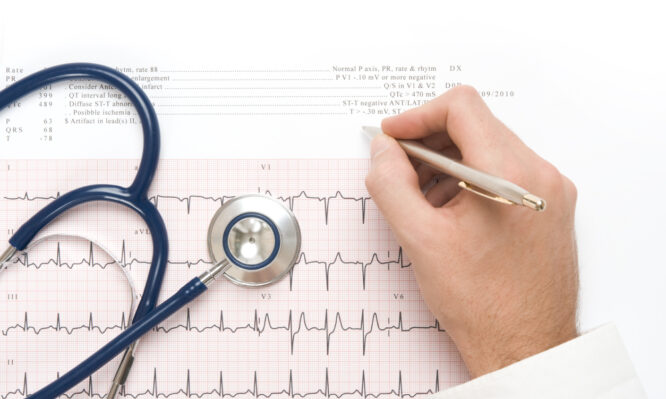 κολπική μαρμαρυγή