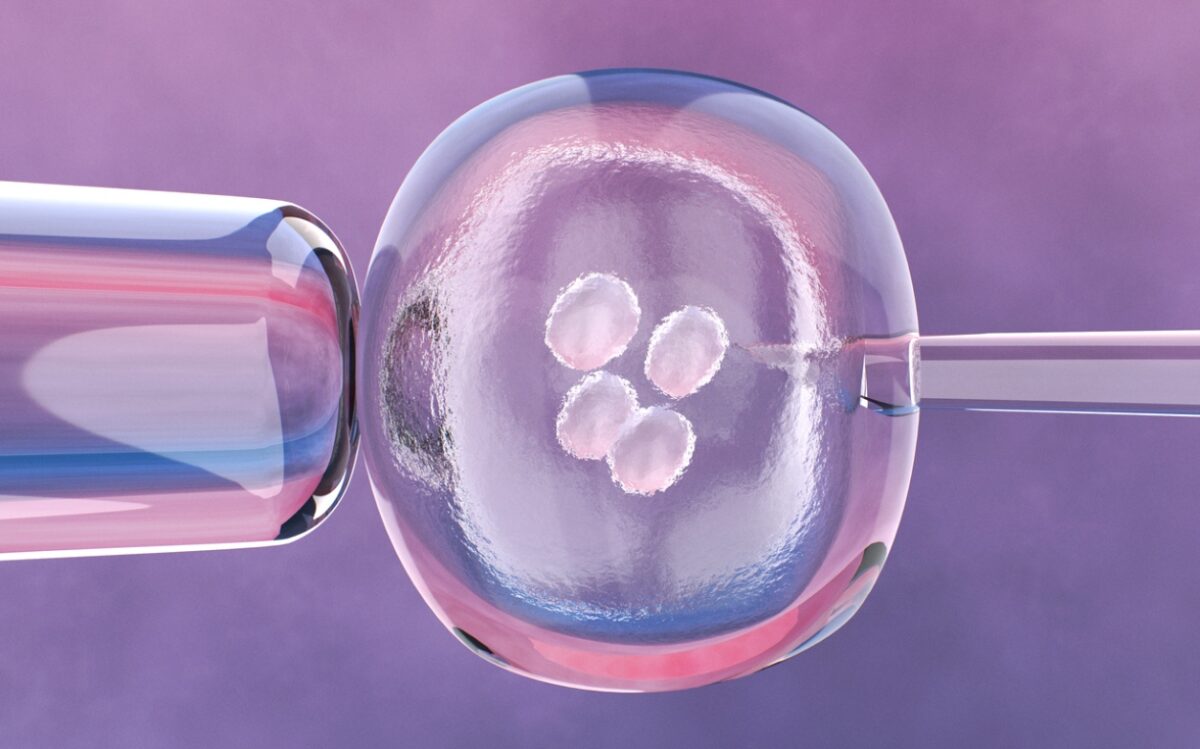 εξωσωματική