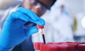 λεμφοκύτταρα