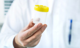 δότες σπέρματος