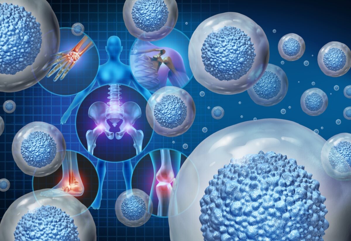 βλαστοκύτταρα